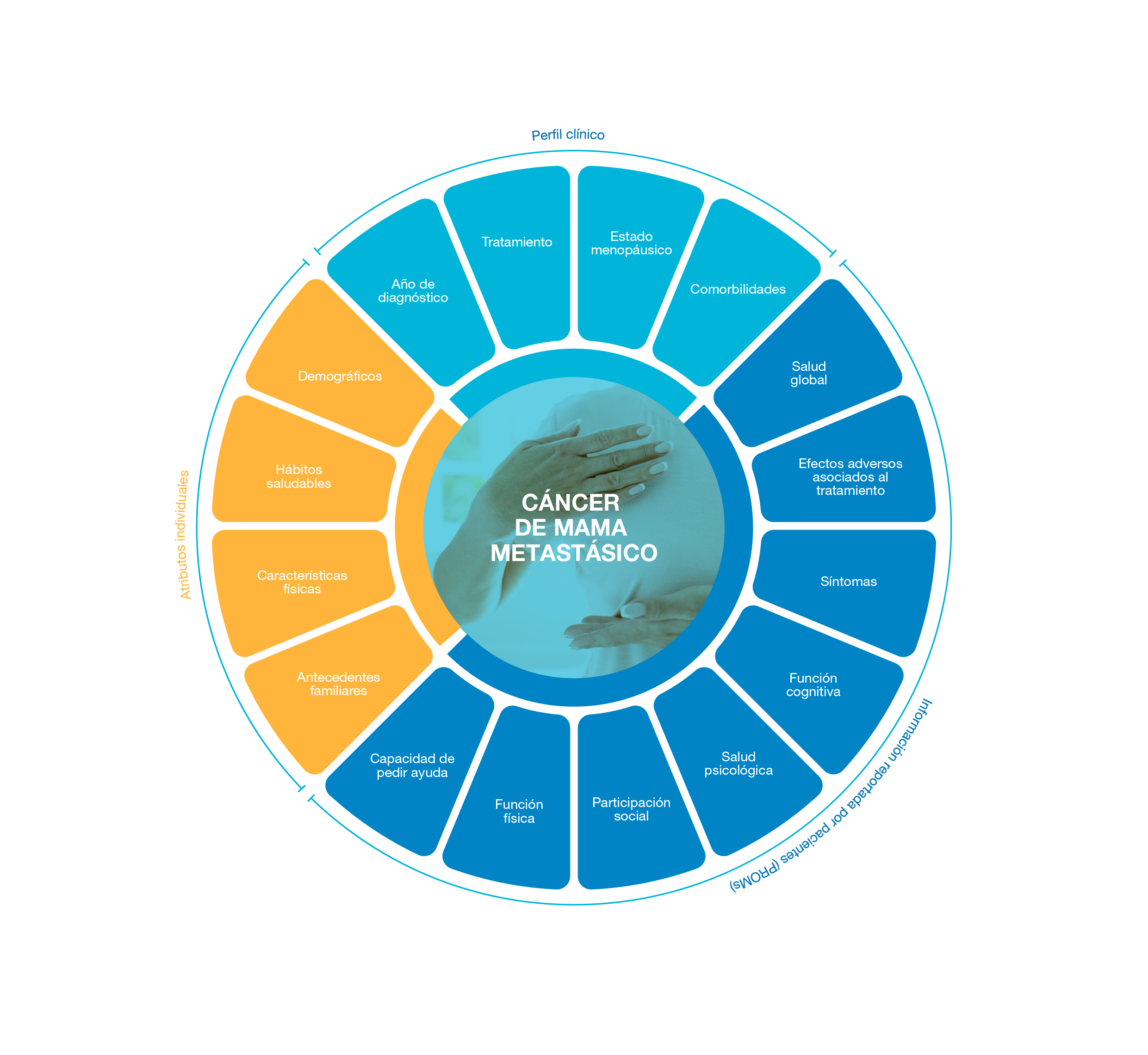 Cáncer de Mama Metastásico